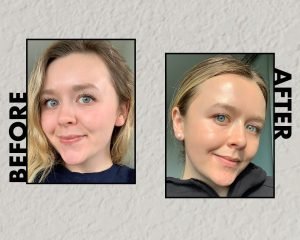 Everything You Should Know About Niacinamide 6 niacinamide