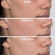 Everything You Should Know About Niacinamide 7 niacinamide